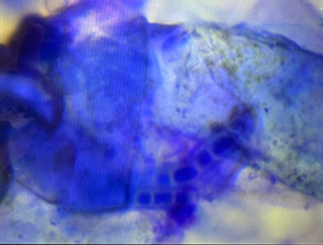 Dermatophytosis in a Dog