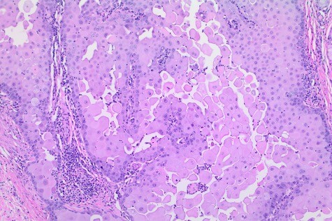 Fig4Sep2024 ISVD Case of the Month - Can You Get the Right Answer?