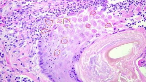 FHV Associated Dermatitis in a 7 Year Old Domestic Shorthair Cat - DermaVet