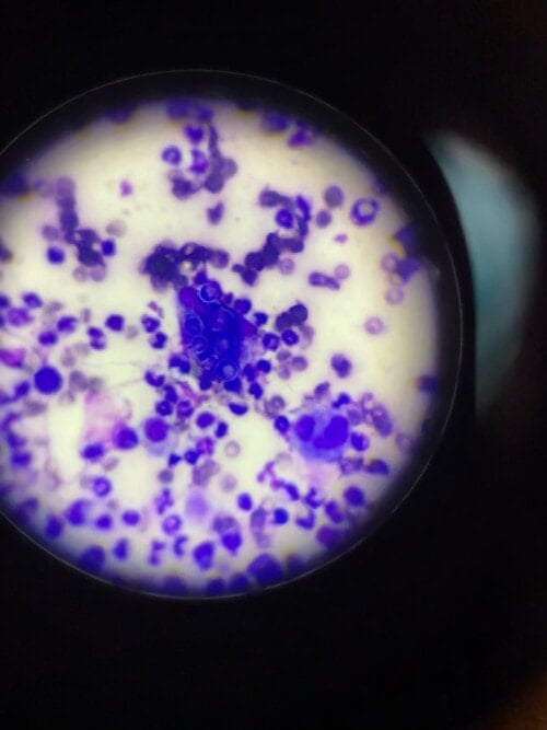 Generalized Blastomycosis in a Great Dane