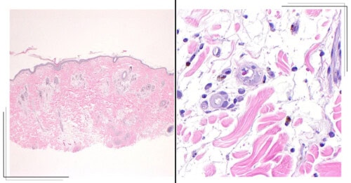 March 2025 COM ISVD Case of the Month - Can You Get the Right Answer?