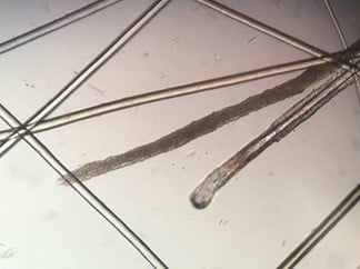 Focal Alopecia in a Cat