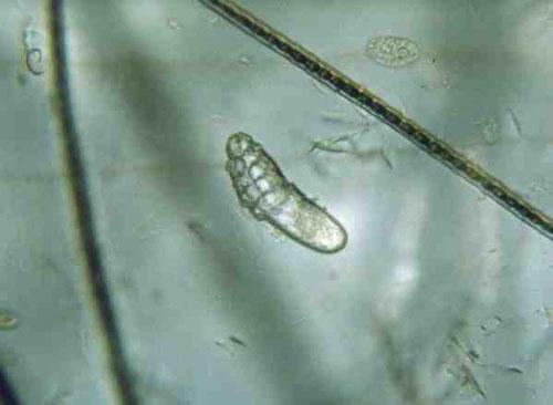 Demodex cornei adulte