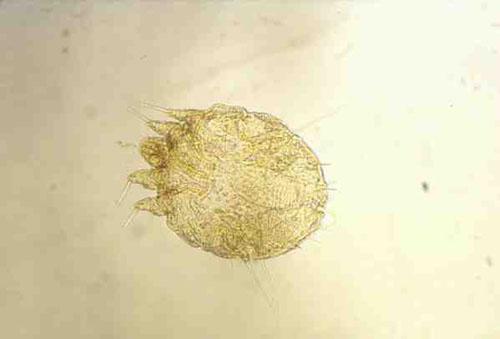 Sarcoptes scabiei adulte femelle