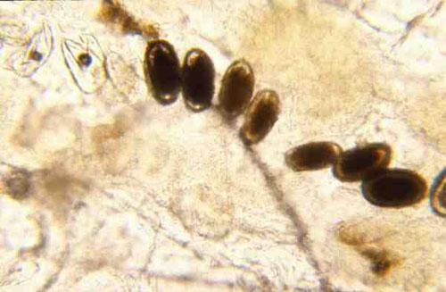 Œufs de Sarcoptes scabiei