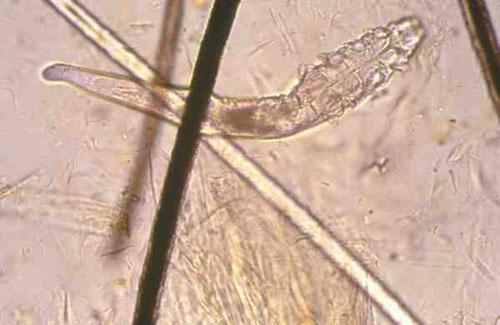 Demodex injai adulte