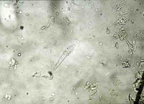 Demodex cati adulte