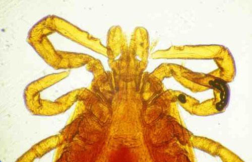 Rostre d'Ixodes ricinus