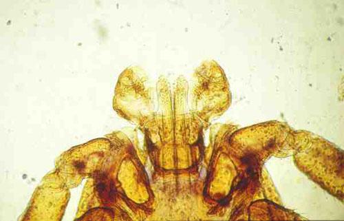 Rostre de Dermacentor reticulatus